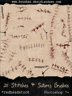 stitches staples suture medical accident skin